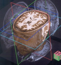 Alexander Rapp's brain